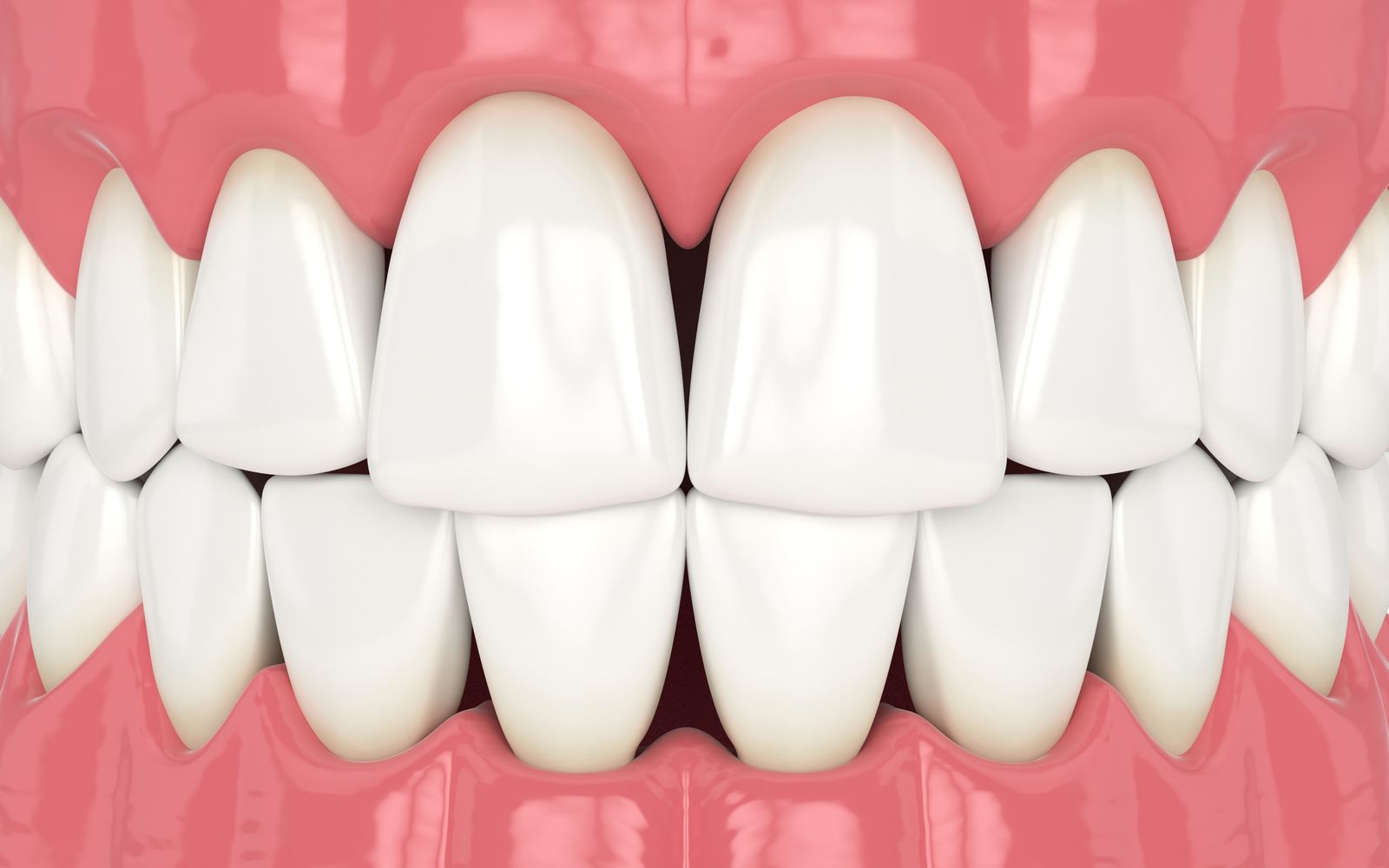 From Causes to Correction: A Guide to Diastema