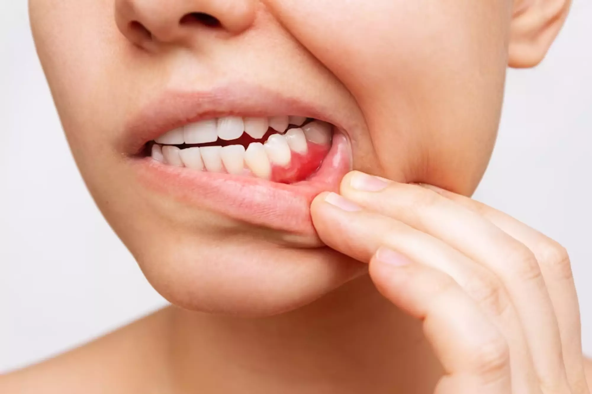 Detecting Signs of Gum Disease Early in East Charlotte